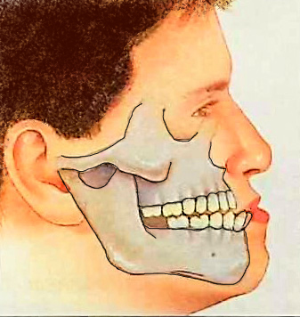 Jaw Before Surgery